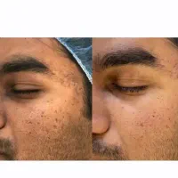 فیشیال بانوان ، آقایان و آموزش