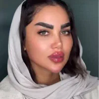 تزریق ژل پک ۱۰ سی سی ۵۹۰۰ جشنواره توسط پزشک