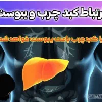 درمان قطعی کبد چرب.یبوست .دیابت و تیروئید