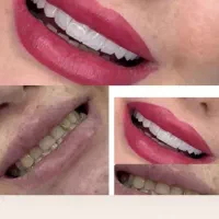 دندان پزشکی آف