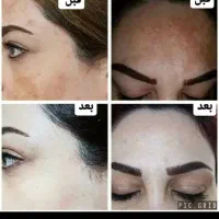 کرم vip بزرگ ضدلک و سفید کننده|آرایشی، بهداشتی، درمانی|گرگان, |دیوار