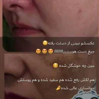 بمب ضدلک و روشن کننده|آرایشی، بهداشتی، درمانی|فسا, |دیوار