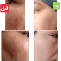 محصولات گیاهی درمانی