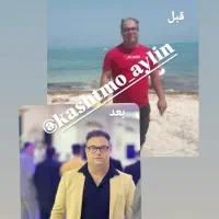 کاشت مو ابروبابروزترین متدروزدنیا|خدمات آرایشگری و زیبایی|خوی, |دیوار