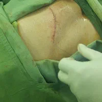 تزریقات،پانسمان و خدمات پرستاری توسط خانم وآقا|خدمات آرایشگری و زیبایی|قرچک, میرزائی شمالی|دیوار