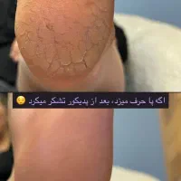 آموزش پدیکور|خدمات آموزشی|بروجرد, |دیوار