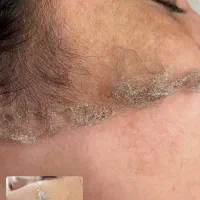 کاشت مژه . لیفت ابرو و لیفت مژه. پاکسازی|خدمات آرایشگری و زیبایی|فولادشهر, C7|دیوار