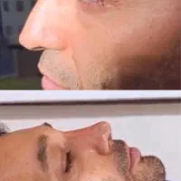 عمل بینی بندرعباس،اقساطی،باکیفیت و تضمین|خدمات آرایشگری و زیبایی|بندرعباس, |دیوار