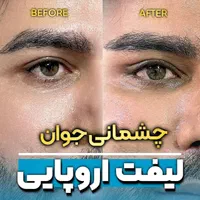 جشنواره لیفت اروپایی چشم پلک ابرو بینی بدون بیهوشی|خدمات آرایشگری و زیبایی|مشهد, هفت تیر (حافظ)|دیوار