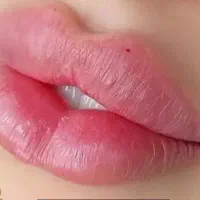 اف ویژه اموزش وخدمات ژل بوتاکس کراتین خال پوست