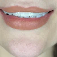 درخواست ادمین پیج اینیستاگرام