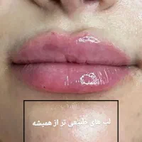 کلینیک زیبایی ویلاشهر (خانم ها،آقایان)|خدمات آرایشگری و زیبایی|نجف‌آباد, ویلاشهر|دیوار