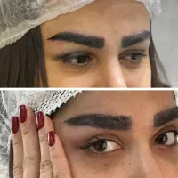کاشت ابرو -نوبت سال جدید-با اقساط