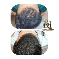 مزوتراپی وprp پوست ومو،فیشیال،مزوژل بوتاکس در مطب|خدمات آرایشگری و زیبایی|شیراز, سجادیه|دیوار