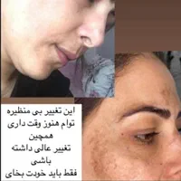 کرم معجزه تضمینی|آرایشی، بهداشتی، درمانی|لردگان, |دیوار