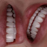 دستیار دندانپزشک خانم (پاره وقت)