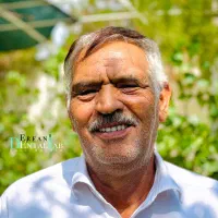 دندان اختصاصی مناسب با چهره شما