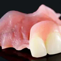 دندان مصنوعی.کامپوزیت دندان.ایمپلنت.فیلیپر.فلکسیبل