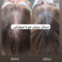 جشنواره کاشت ابرو با افر استثنایی/مزوتراپی|خدمات آرایشگری و زیبایی|جهرم, |دیوار