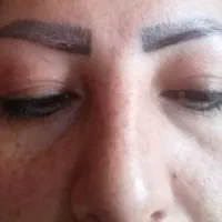 مراقبت پوستی|آرایشی، بهداشتی، درمانی|تهران, شهرک رضویه|دیوار