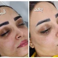 فیشیال تخصصی|خدمات آرایشگری و زیبایی|محمدشهر, محمدشهر|دیوار