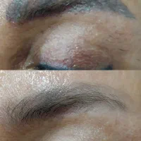 ریموو ارایش دائم ۱۰۰ درصد تضمینی|خدمات زیبایی و سلامت|کرمانشاه, |دیوار