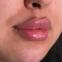 منشی دستیار و اپراتور لیزر خانم مجرد با حقوق بالا