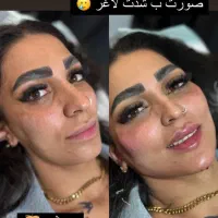 تخفیف جشنواره تزریق ژل و فیلر لب و فول فیس در مطب|خدمات آرایشگری و زیبایی|اصفهان, چرخاب|دیوار