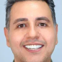 جشنواره کلیه خدمات دندانپزشکی با اقساط ۱۵ ماهه|خدمات آرایشگری و زیبایی|تبریز, |دیوار