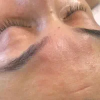 فیشیال و کربوکسی تراپی تخصصی پوست با تخفیفات ویژه|خدمات آرایشگری و زیبایی|قرچک, میرزائی شمالی|دیوار
