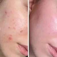 پودر کلاژن لاکچری کوین