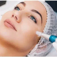 میکرونیدلینگ معجزه جوانسازی|خدمات آرایشگری و زیبایی|صدرا-فارس, فاز ۲|دیوار