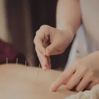 حجامت و زالوتراپی و طب سوزنیو پاکسازی بدن از سمو