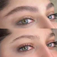 مدل میکروبلیدینگ بدون هزینه