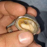 انگشتر سلیمانی