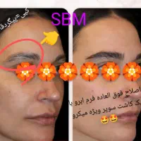 کاشت فوق حرفه/جدیدترین متدسوپرمیکروit+ مو/ابرو/ریش|خدمات آرایشگری و زیبایی|مشهد, هفت تیر (آب و برق)|دیوار