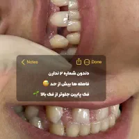 آموزش و کامپوزیت تکنیک جدید|خدمات آرایشگری و زیبایی|اهواز, زیتون کارمندی|دیوار
