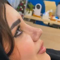 سال جدید تحفیف عمل بینی لیپو ابدولیفت مامو پروتز