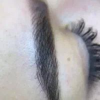انجام تتو فیبروز قاب و سایه