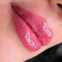 تزریق ژل لب وکانتورینگ(+بوتاکس رایگان|خدمات آرایشگری و زیبایی|کرمانشاه, |دیوار