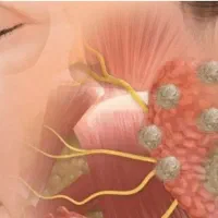 منیر ( قابل توجه بیماران منیر )|آرایشی، بهداشتی، درمانی|شیراز, لشکری|دیوار