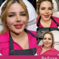 تخفیفات ویژه جشنواره تا 20 آذرماه بمناسبت روزمادر