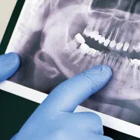 جذب دندانپزشک دارای پروانه خرم آباد