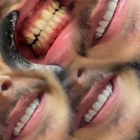 کلینیک تخصصی کامپوزیت از فکی ۵ تومن