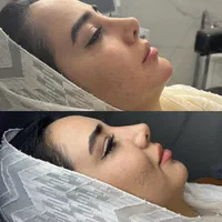 جشنواره تخفیفات در کلینیک پوست مو زیبایی|خدمات آرایشگری و زیبایی|تهران, امیرآباد|دیوار