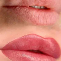 شیدینگ لب،تینت لب،درمان تیرگی لب،درمان فوردایس|خدمات آرایشگری و زیبایی|ساری, |دیوار
