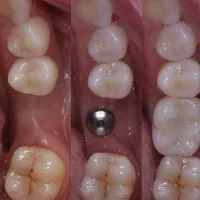 خدمات دندانپزشکی تخصصی کلینیک دی با اقساط بلند مدت|خدمات آرایشگری و زیبایی|پارسآباد, |دیوار