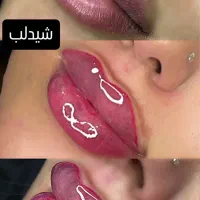 شیدلب وهاشوروفیبروز فقط۱وپانصدتضمینی