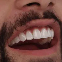 کامپوزیت|پزشکی|خرم‌آباد, |دیوار