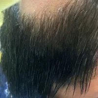 فر مردانه حرفه ایی با دوام بالا و حالت طبیعی|خدمات آرایشگری و زیبایی|ایلام, |دیوار